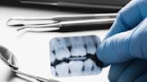 Millions expected to lose dental care coverage after Medicaid review
