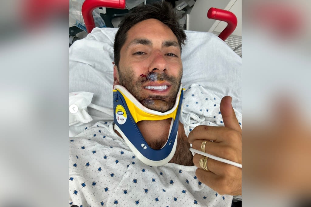 ‘Catfish’ host Nev Schulman breaks neck in L.I. bike accident