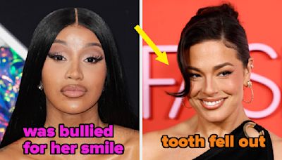 It Feels Like Everyone Is Getting Veneers, So Here Are 20 Celebs Who Have Them
