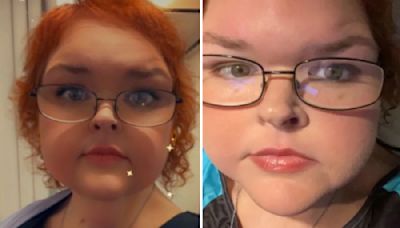 1000 Lb Sisters: Why Is Tammy Slaton Not Getting Skin Removal Surgery?