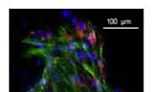 Immune-checkpoint inhibitors protect bone by promoting osteogenesis, exploratory study shows