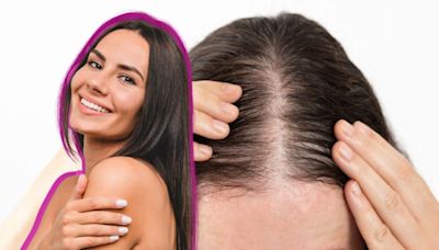 ¿Cómo puedes evitar la caída del cabello? Con la guía de los 5 alimentos que revitalizan tu pelo de raíz