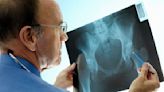 Brits face waiting decades for hip and knee operations