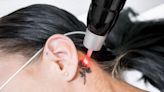 Woman Exploits Passive-Aggressive $500 Tattoo Removal Gift From Mother-in-Law