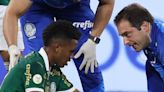 Palmeiras: Estêvão sofre torções no tornozelo e no joelho e vira desfalque