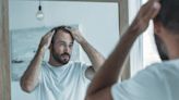 Can You Make Topical Finasteride For Hair Loss at Home?
