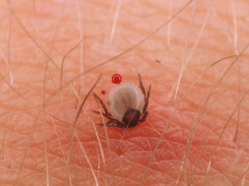 Lyme disease increase risk due to climate change