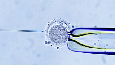 Costly add-on offered by IVF clinics ‘does not increase odds of having a baby’