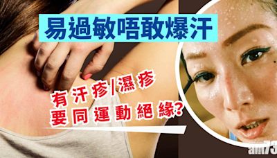 皮膚易敏感一出汗就濕疹 係咪盡量避免做運動？ | am730