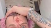 Machine Gun Kelly Shows Off Bloody Face After 'Insane' Cleveland Show