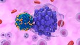 New Clues to Origin of T-Cell Lymphoma After CAR-T Therapy