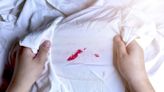 'Game-changing' hack to remove stubborn clothing stains that’s totally free to do