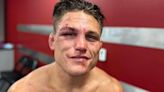 Drew Dober issues statement following TKO loss to Jean Silva at UFC Denver | BJPenn.com
