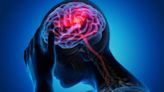 Discrepancies between brain regions could help predict risk of psychosis, study finds