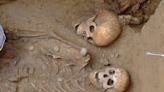 三萬年骨骸刷新考古史 專家：最早的手術