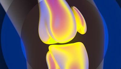 Not ready for a knee replacement? You might be able to fix your cartilage instead.