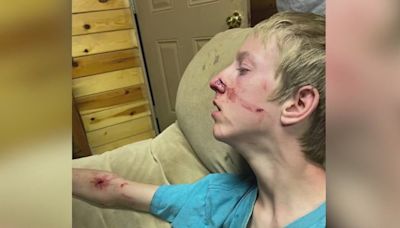 Family comes to rescue of 15-year-old attacked by a bear in Apline