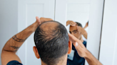 Is platelet-rich plasma treatment the ultimate solution for hair loss? - Times of India