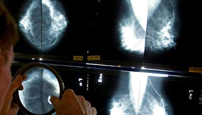 40 the new target age for breast cancer screening: Canadian Cancer Society