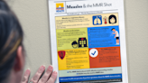 Columbus, CDC team up for measles prevention