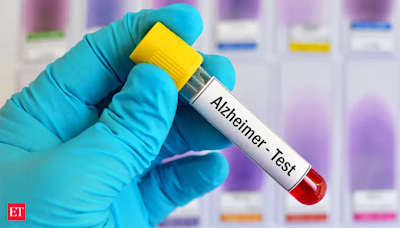 Blood tests for Alzheimer's may be coming to your doctor's office. Here's what to know
