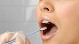 What to Know About Mouth Swab Drug Tests