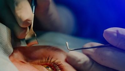 Drastic reduction in HSE reimbursement for cataract surgery causes ‘shock and anger’