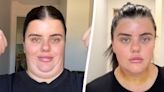 'I spent £2k removing my double chin - it went from saggy to defined overnight'