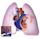 Pulmonary hypertension