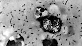 Health officials in Colorado confirm a rare case of human plague