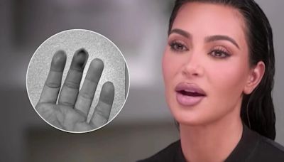 Kim Kardashian sufrió una fractura en su mano tras golpearse con una puerta: “Parecía que el hueso sobresalía”