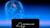 Retroceso para Neuralink: implante cerebral en humano no funciona correctamente - La Opinión