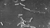 Aumenta el número de muertes en EEUU por infección bacteriana relacionada con gotas oftálmicas