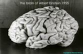 Brain of Albert Einstein