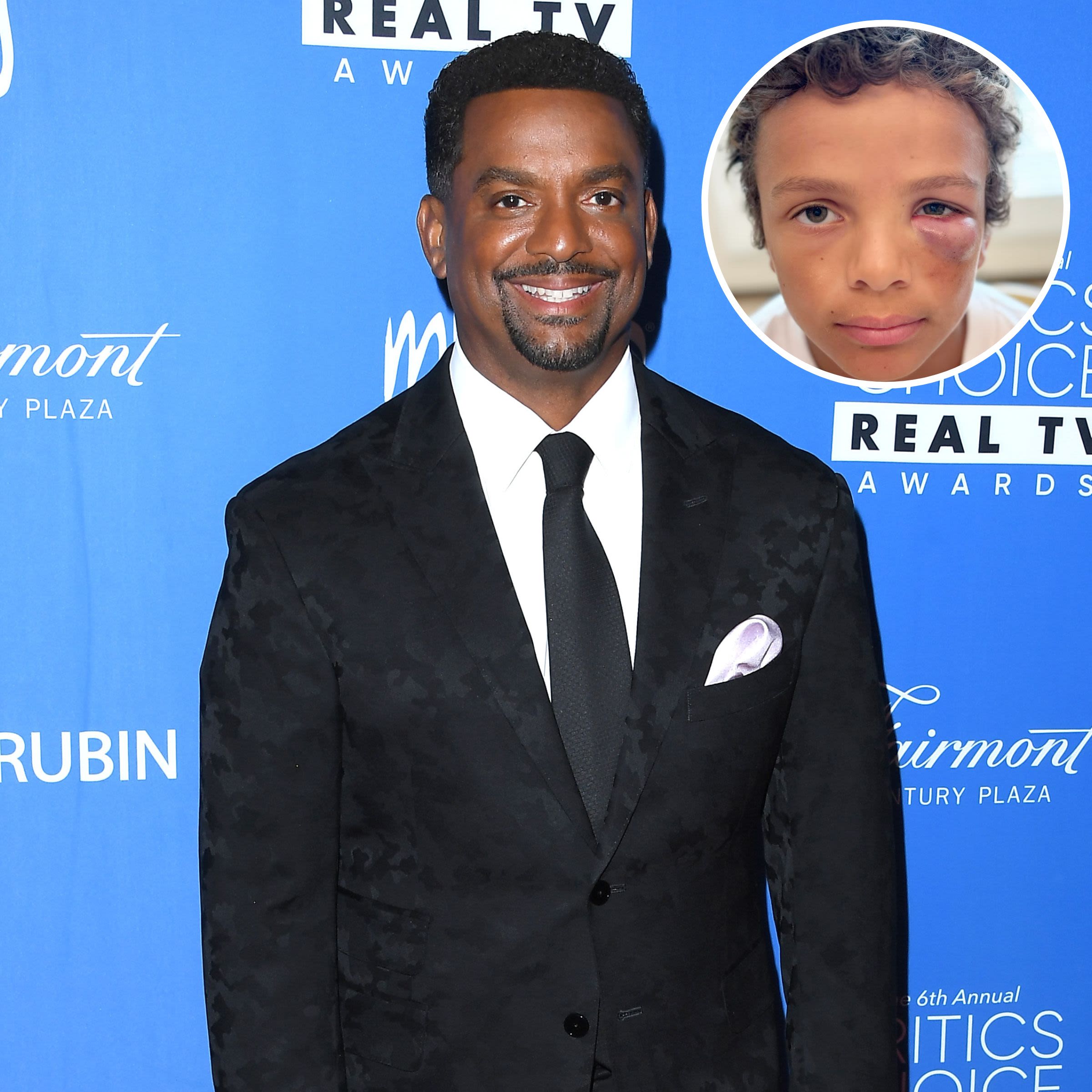 Alfonso Ribeiro Gives Update After Son AJ Is Hit in the Eye With Baseball During Practice