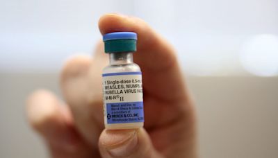 Vanderbilt doctors identify first measles case in Tennessee since 2019