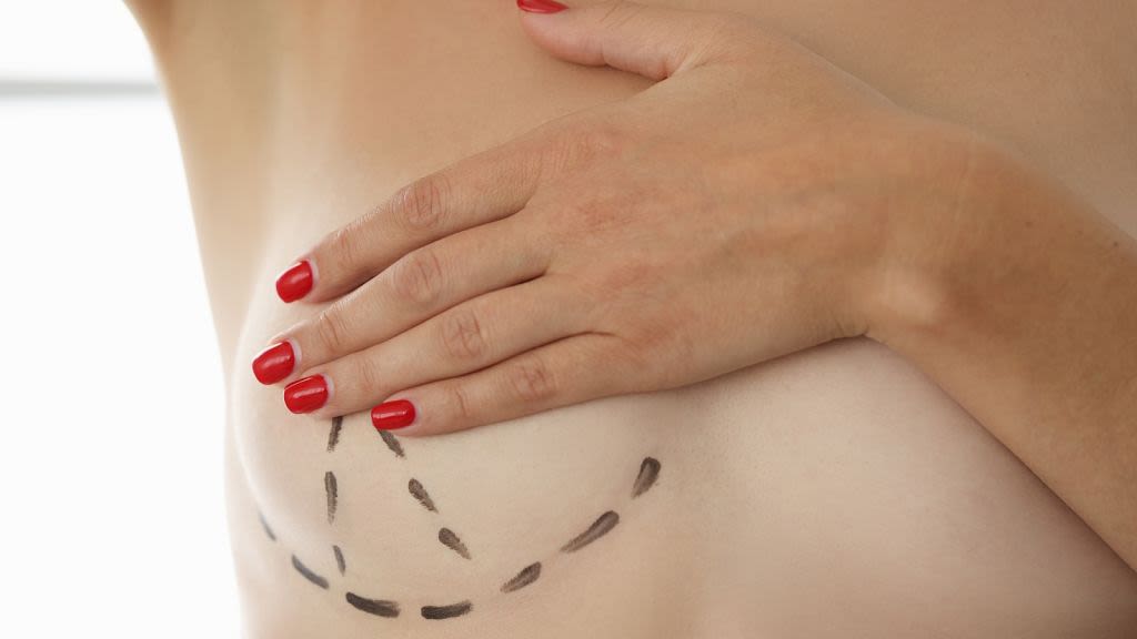 Cases of 'breast implant illness' causing a spike in the number of women seeking removal surgery