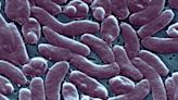 Rare Flesh-Eating Bacteria Infections Kill 3 In Connecticut, New York