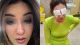 Jasmin Bhasin's Corneas Get Damaged After Wearing Lenses: 'In Excruciating Pain, I Can't See'; Check Pics