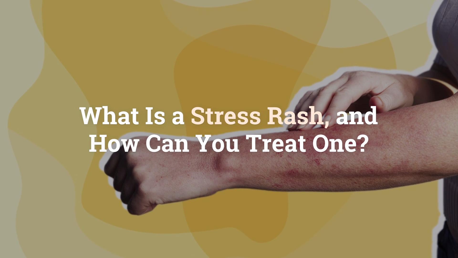 what-is-a-stress-rash-and-how-can-you-treat-one