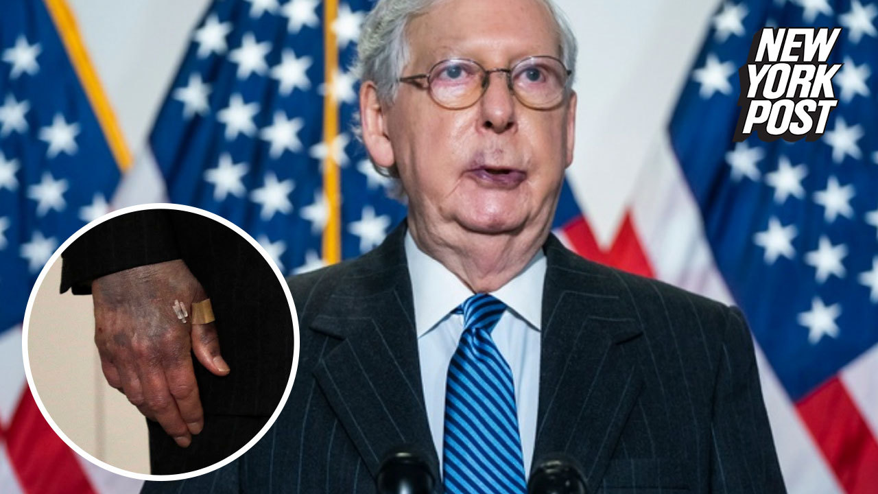 Mitch Mcconnell Dodges Health Questions Despite Bruised Face Bandaged Hands