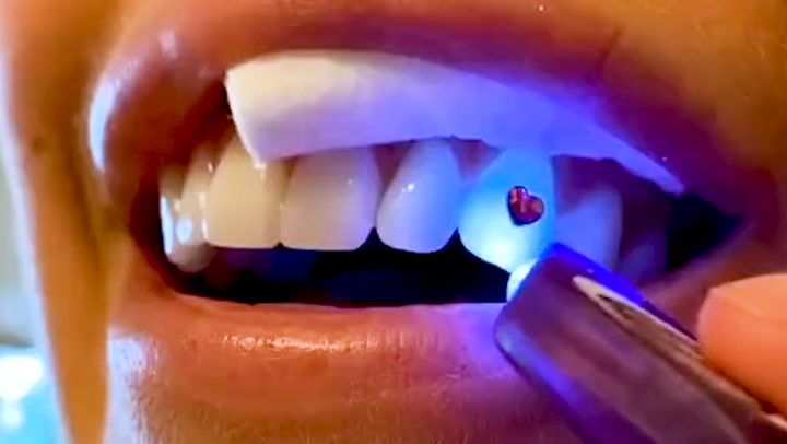 Lingouzi Tooth Gem Kit- DIY Tooth Crystal Set with 20 Pieces