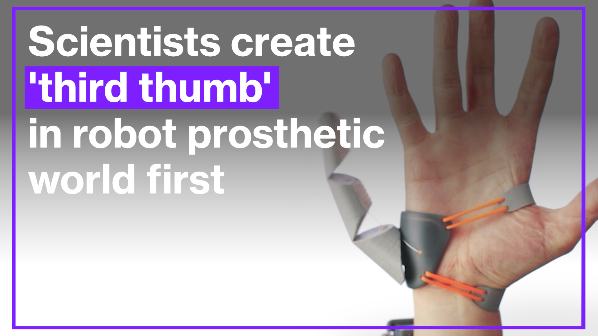 Scientists create 'third thumb' in robot prosthetic world first