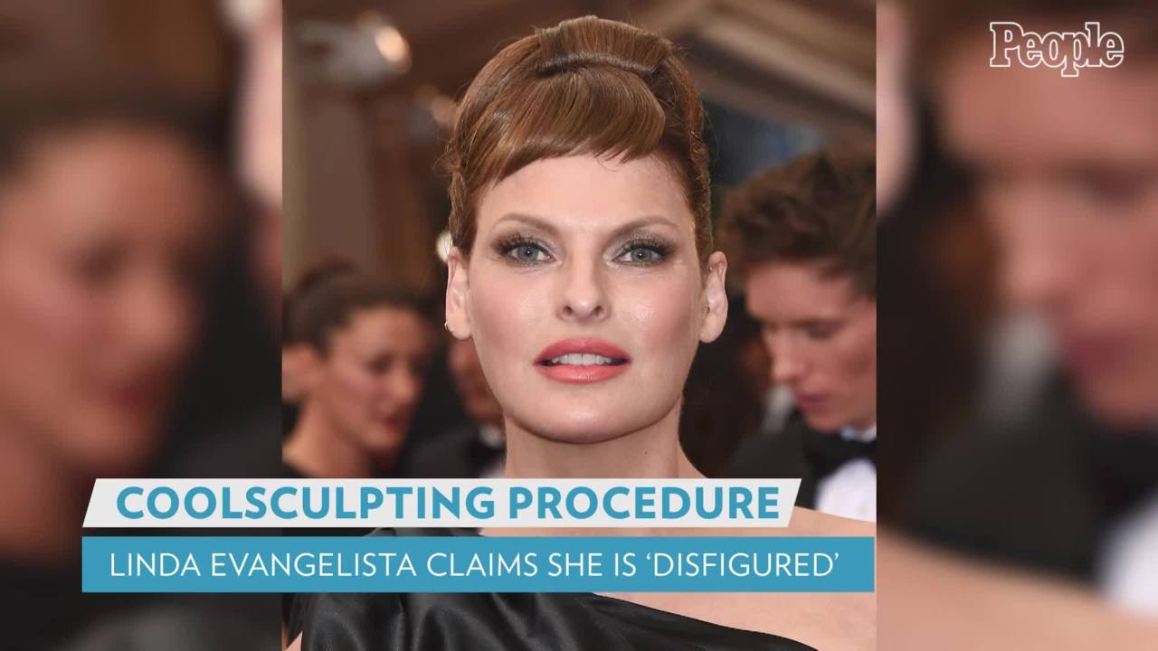 Linda Evangelista After Coolsculpting