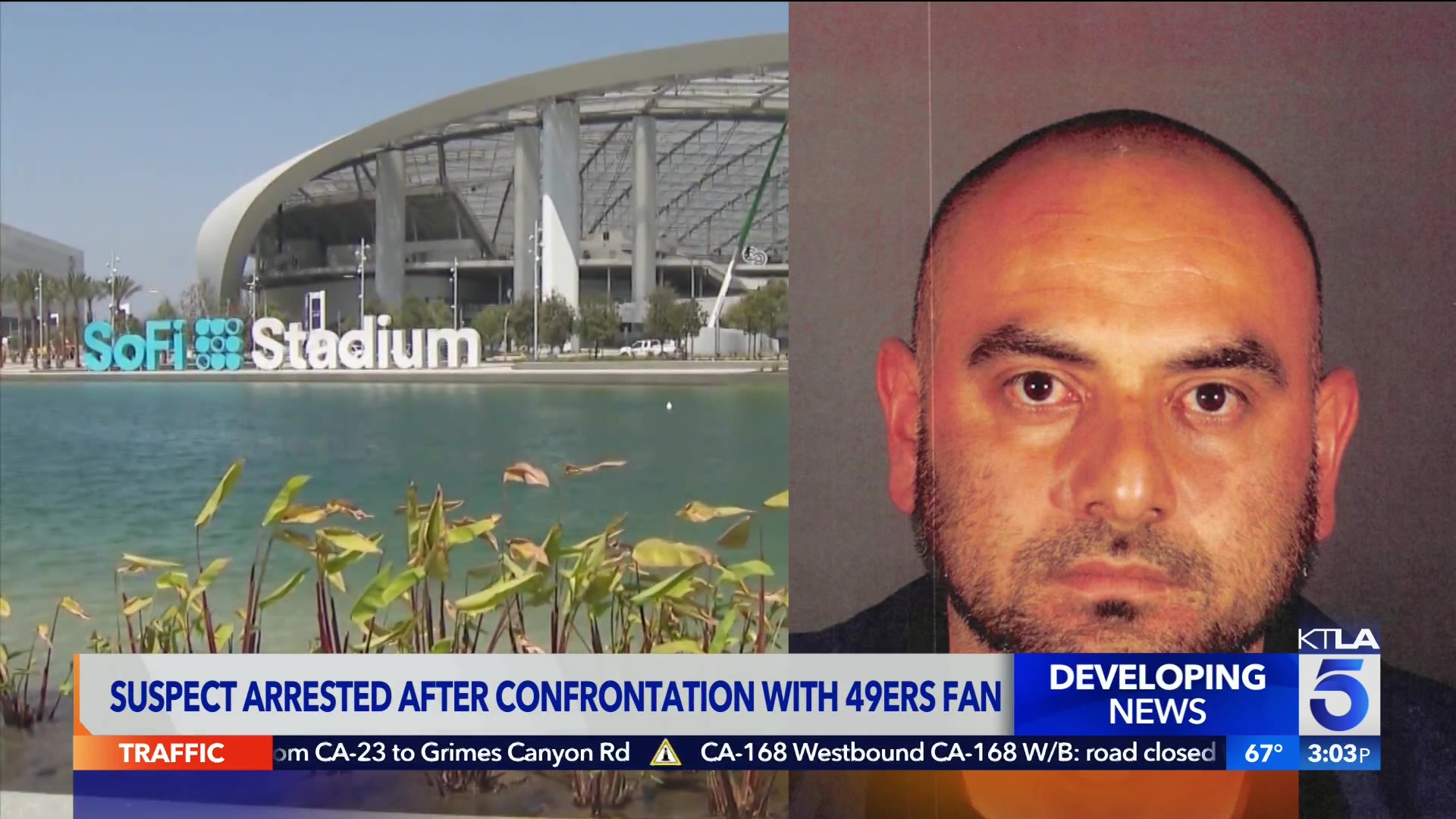 49ers: Suspect arrested for putting SF fan in medically induced coma