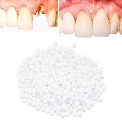 10/20/50/100g Temporary Tooth Repair Kit-Thermal Beads Fix Missing/ Broken  Teeth