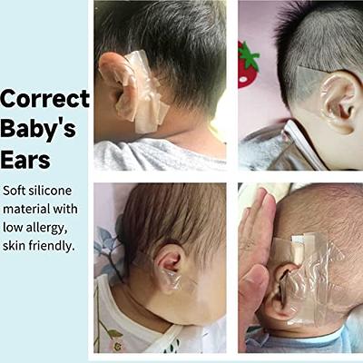 Baby Ear Corrector, Infant Ear Tape for Babies, Baby Silicone Gel Ear Tape  4cmx50cm Perfect Tape for Correcting Newborn's Ear,otostick Ear Corrector -  Yahoo Shopping