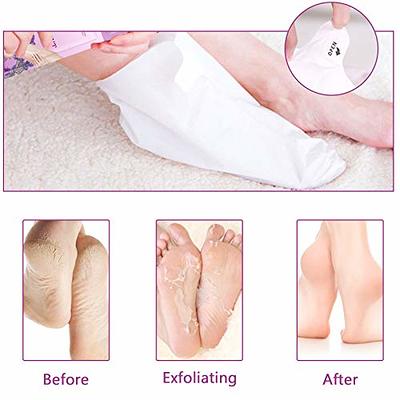 Foot Cure Foot Exfoliator & Callus Remover Pedicure Set Foot Care Kit  Includes Foot File for Dead Skin, Tea Tree Oil Foot Soak Salts, Urea Cream  40 Percent & Foot Callus Removal