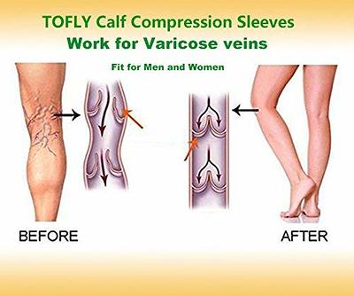 TOFLY® Calf Compression Sleeve for Men & Women, 1 Pair, Footless
