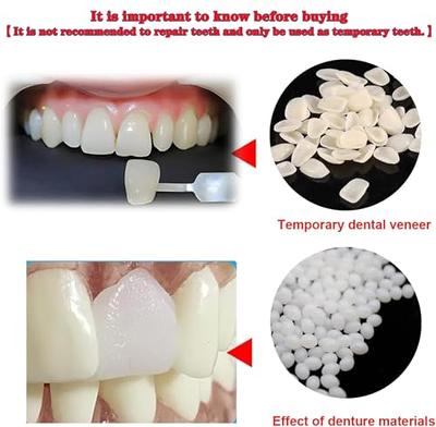 Temporary Tooth,teeth Repair Kit, Temporary Teeth Replacement Kit, Moldable  False Teeth, Thermal Fit